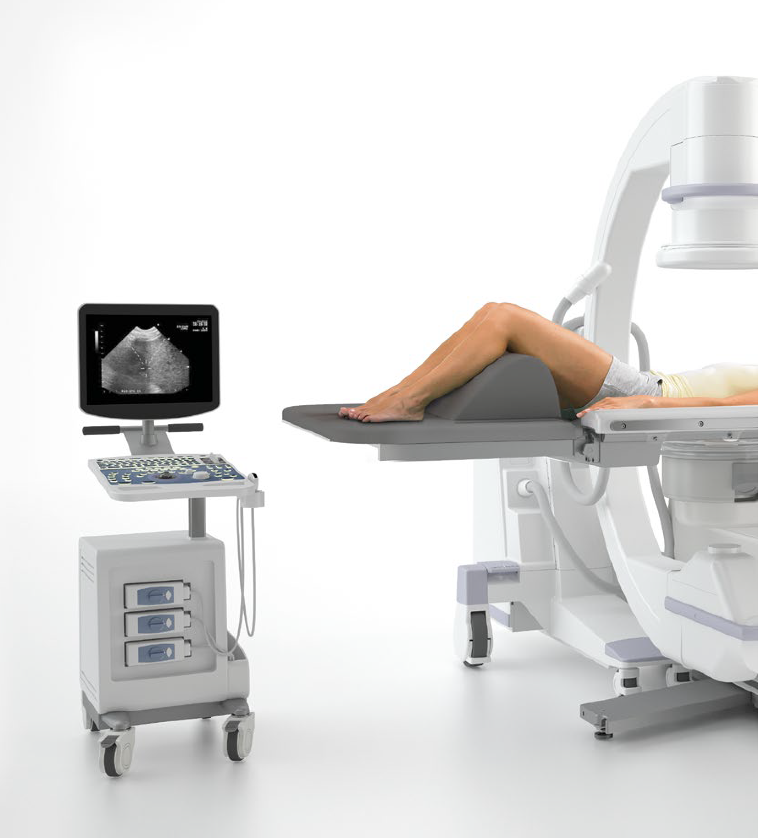 new kidney stone treatment